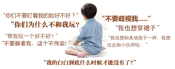 儿童白癜风危害的表现