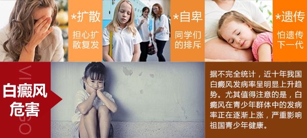 如何对症治疗白癜风