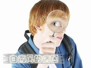 中年人白癜风的病因是什么